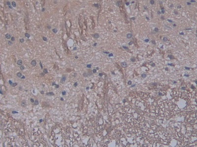 白介素1α(IL1a)单克隆抗体