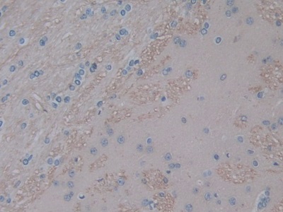 白介素1α(IL1a)单克隆抗体
