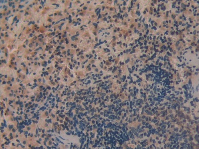 白介素1α(IL1a)单克隆抗体