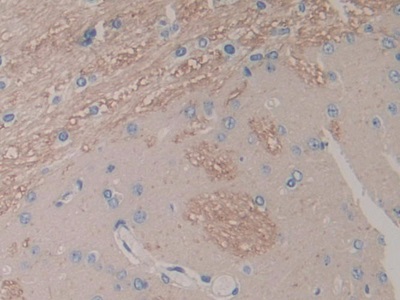 白介素1α(IL1a)单克隆抗体