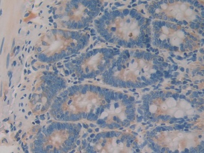 白介素1α(IL1a)单克隆抗体