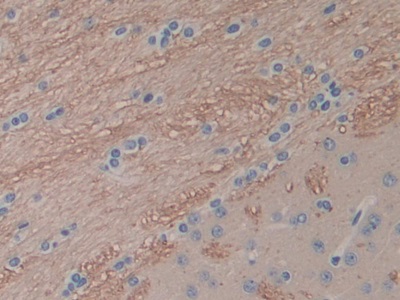 白介素1α(IL1a)单克隆抗体