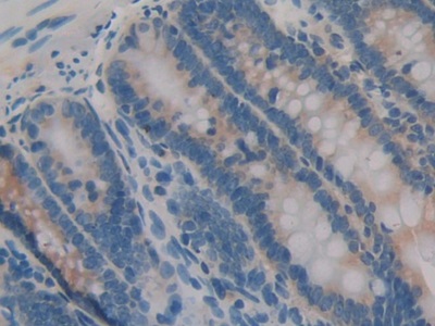 白介素1α(IL1a)单克隆抗体