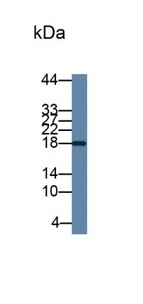 白介素2(IL2)单克隆抗体