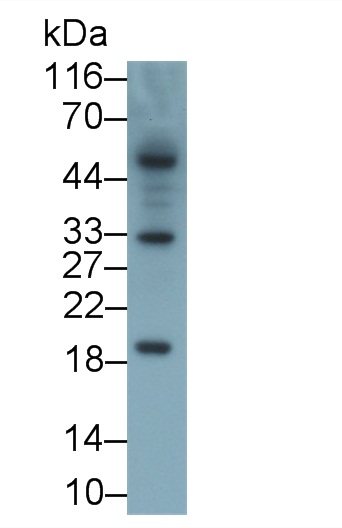 白介素2(IL2)單克隆抗體