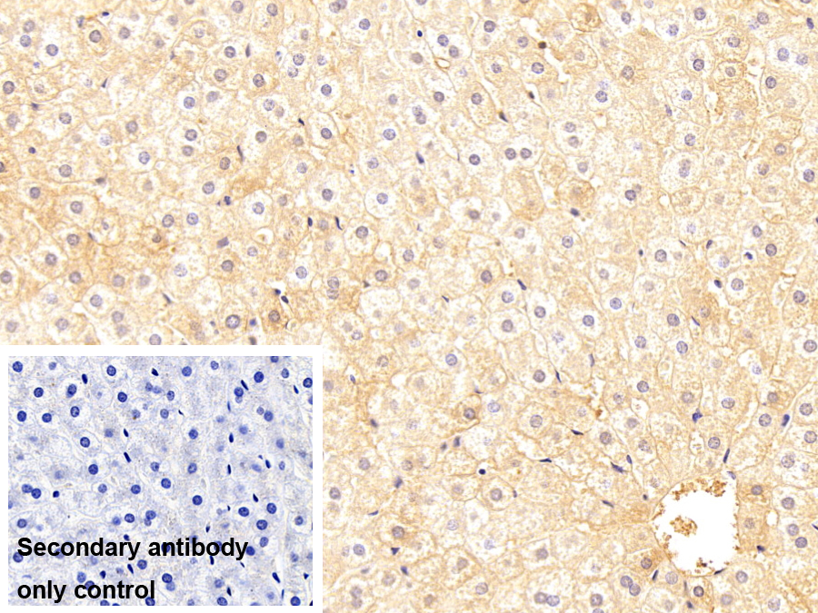 免疫球蛋白G1(IgG1)單克隆抗體