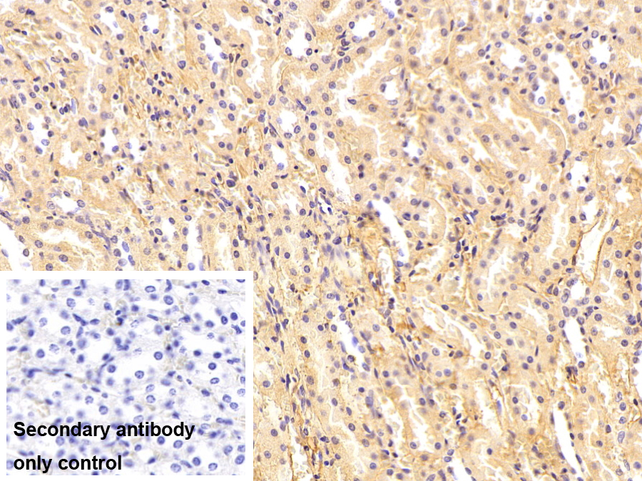 免疫球蛋白G1(IgG1)單克隆抗體