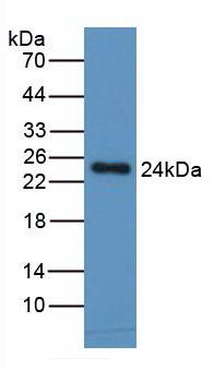 單核細胞趨化蛋白1(MCP1)單克隆抗體