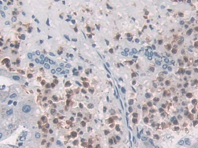巨噬细胞炎性蛋白3α(MIP3a)单克隆抗体