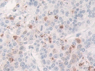 巨噬细胞炎性蛋白3α(MIP3a)单克隆抗体