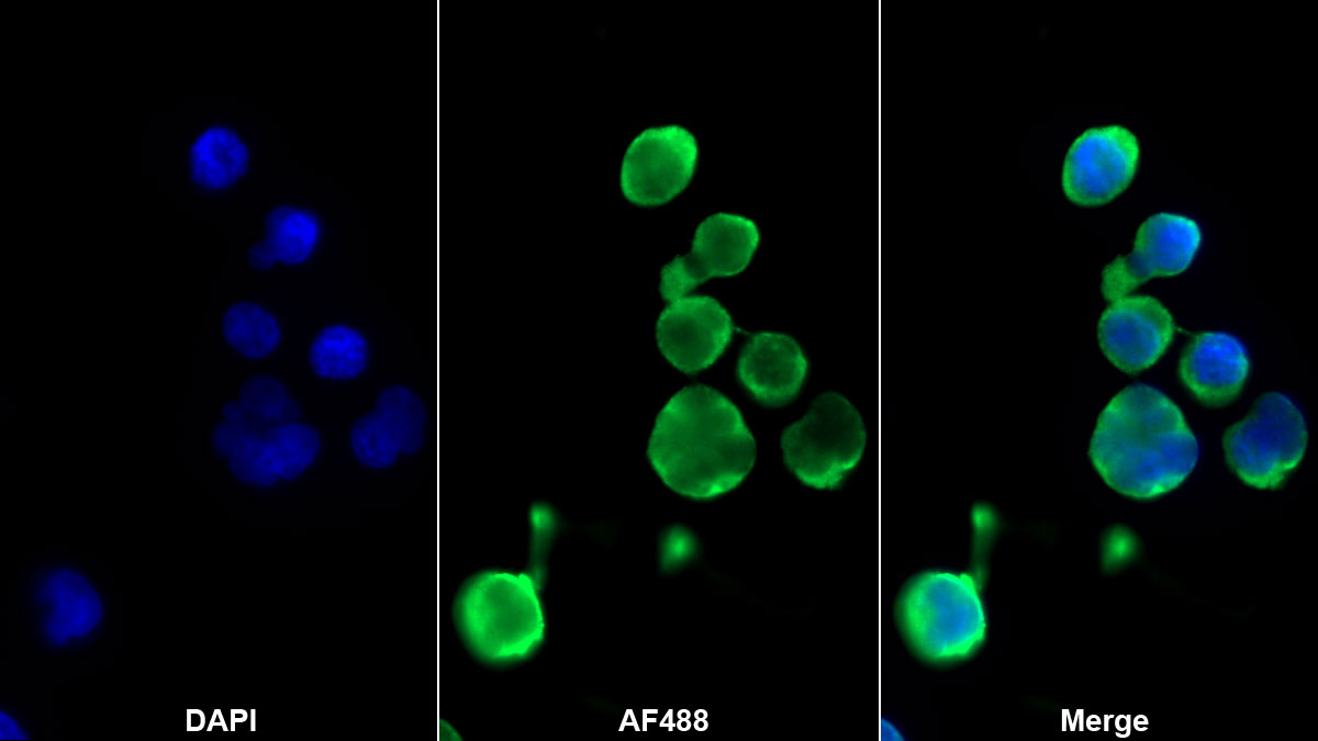 CD40配體(CD40L)單克隆抗體