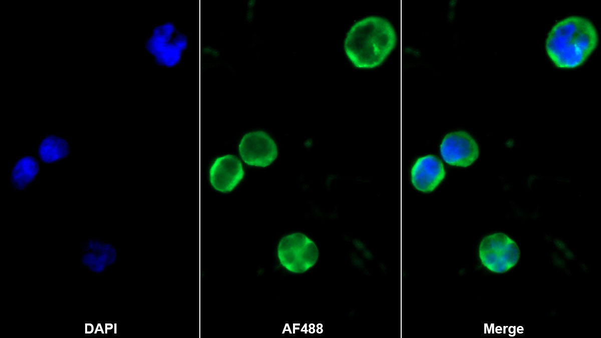 CD40配体(CD40L)单克隆抗体