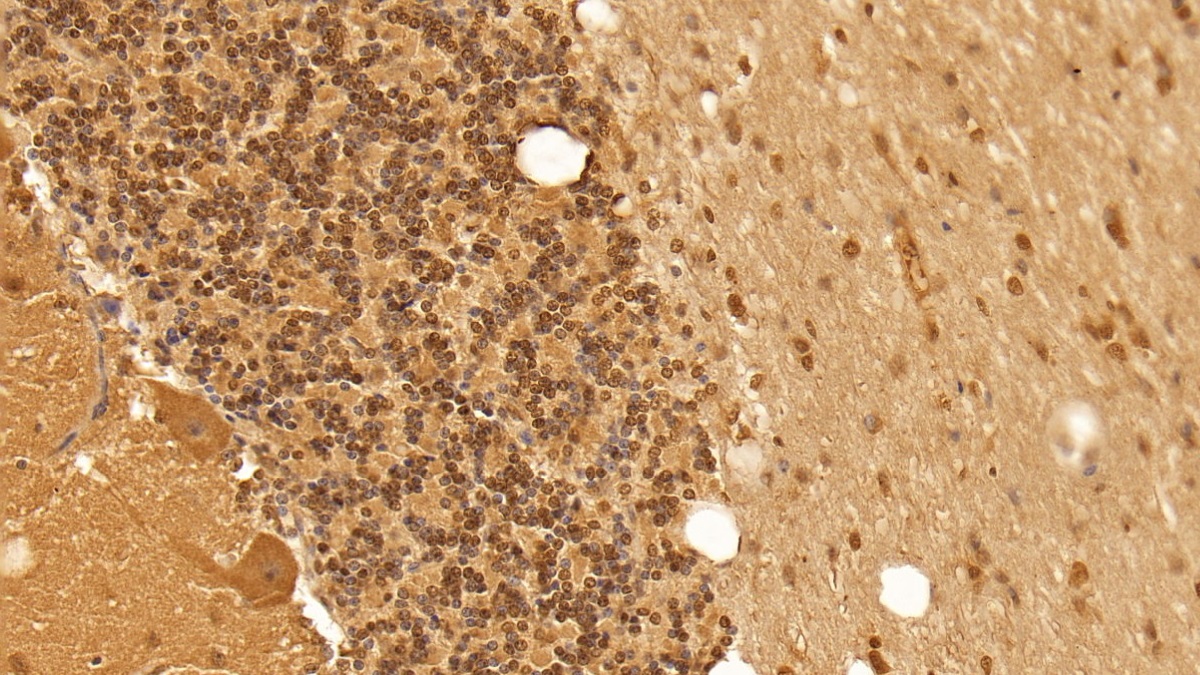 轉(zhuǎn)化生長因子β1(TGFb1)單克隆抗體