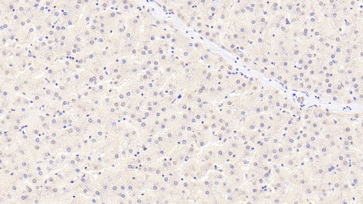 α2-抗纖維蛋白溶酶(a2PI)單克隆抗體