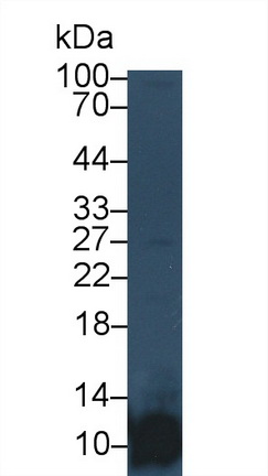 血小板因子4(PF4)單克隆抗體