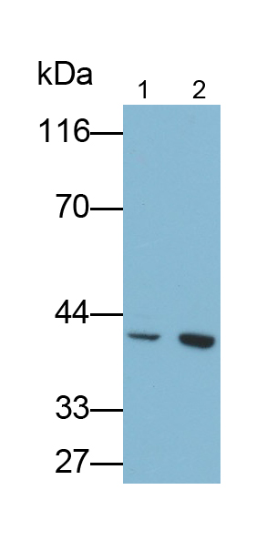 轉(zhuǎn)化生長因子β2(TGFb2)單克隆抗體