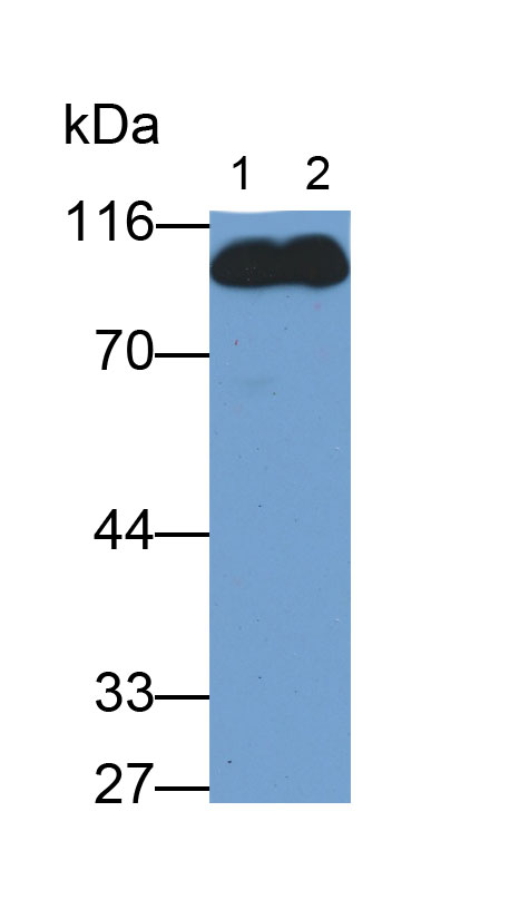 補體1抑制因子(C1INH)單克隆抗體