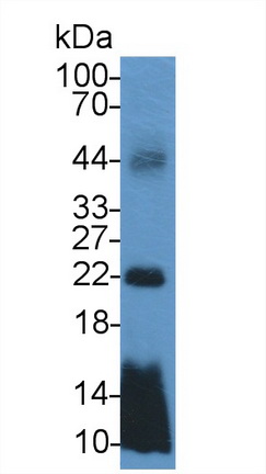 载脂蛋白C1(APOC1)单克隆抗体