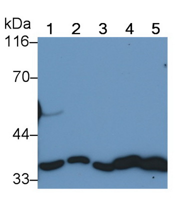 膜联蛋白A5(ANXA5)单克隆抗体