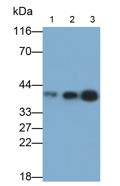 組織蛋白酶K(CTSK)單克隆抗體