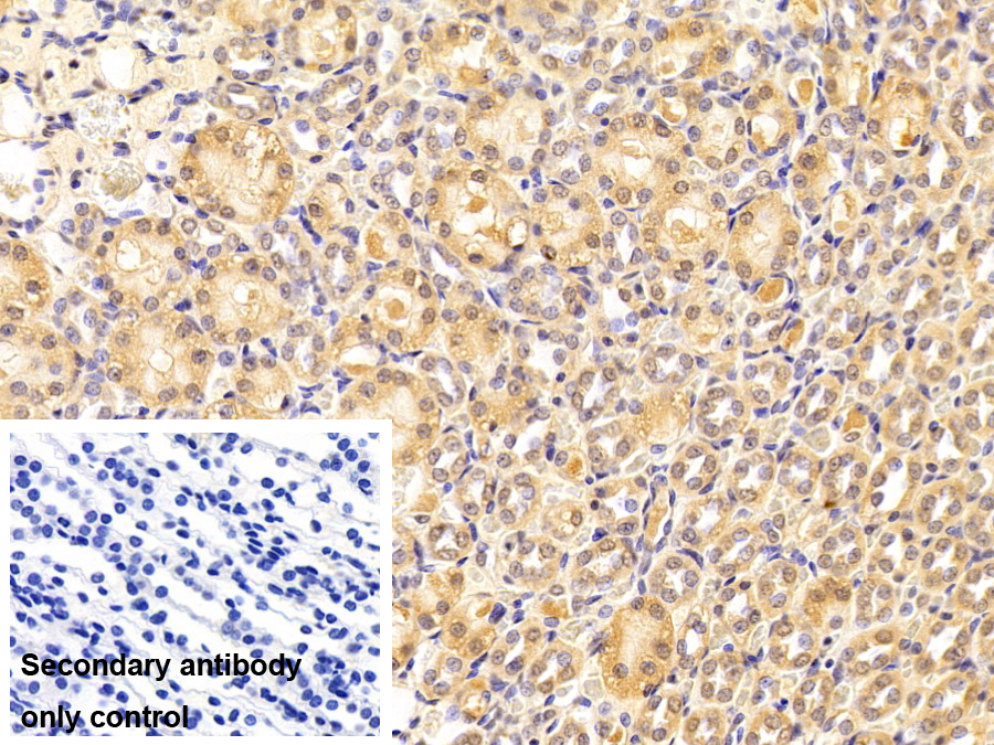 转运蛋白1(TNPO1)单克隆抗体