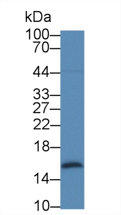 半乳糖凝集素2(GAL2)单克隆抗体