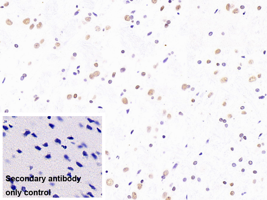 不均一核糖核蛋白A2/B1(HNRPA2B1)單克隆抗體