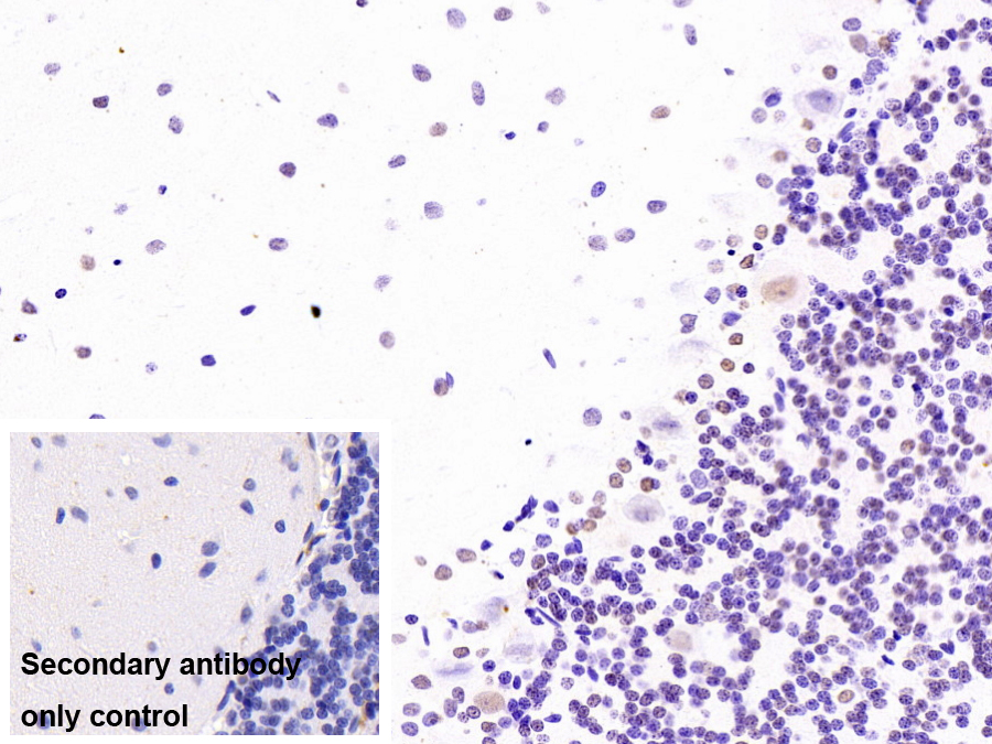 不均一核糖核蛋白A2/B1(HNRPA2B1)單克隆抗體