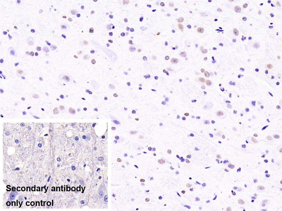 不均一核糖核蛋白A2/B1(HNRPA2B1)單克隆抗體