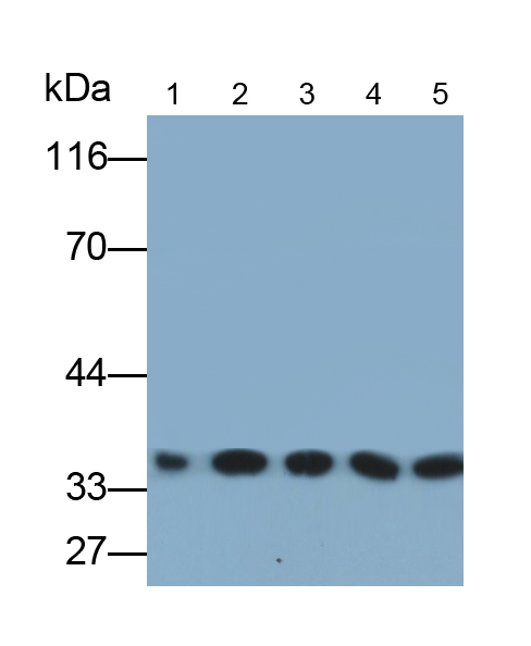 不均一核糖核蛋白A2/B1(HNRPA2B1)单克隆抗体