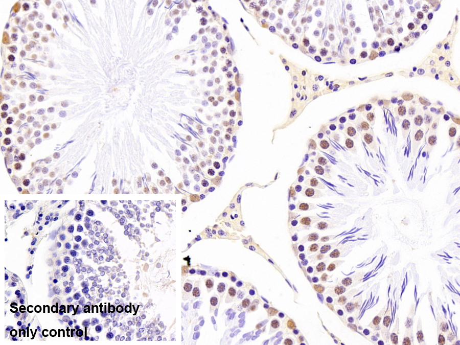 不均一核糖核蛋白A2/B1(HNRPA2B1)單克隆抗體