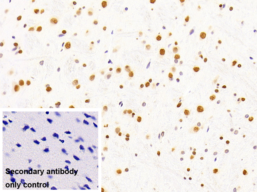 不均一核糖核蛋白A2/B1(HNRPA2B1)單克隆抗體