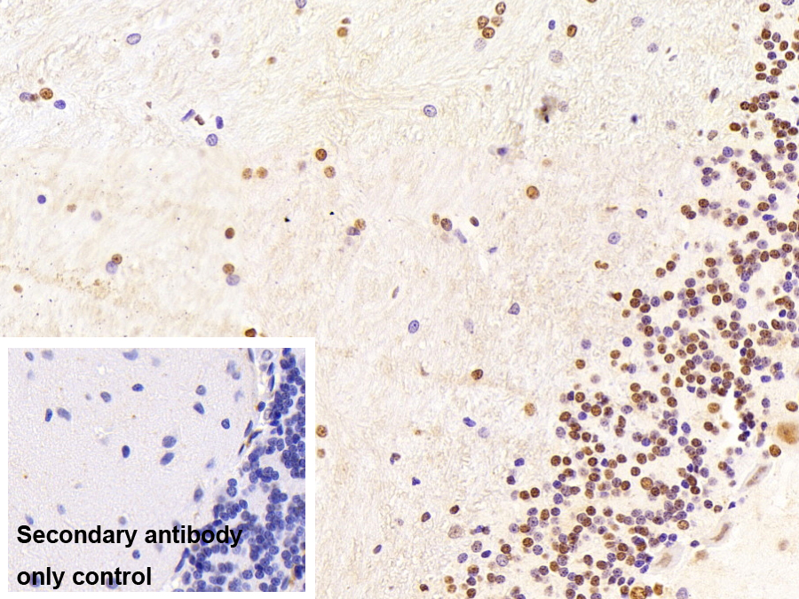 不均一核糖核蛋白A2/B1(HNRPA2B1)單克隆抗體