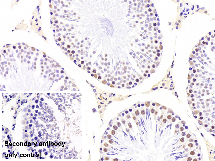 不均一核糖核蛋白A2/B1(HNRPA2B1)單克隆抗體