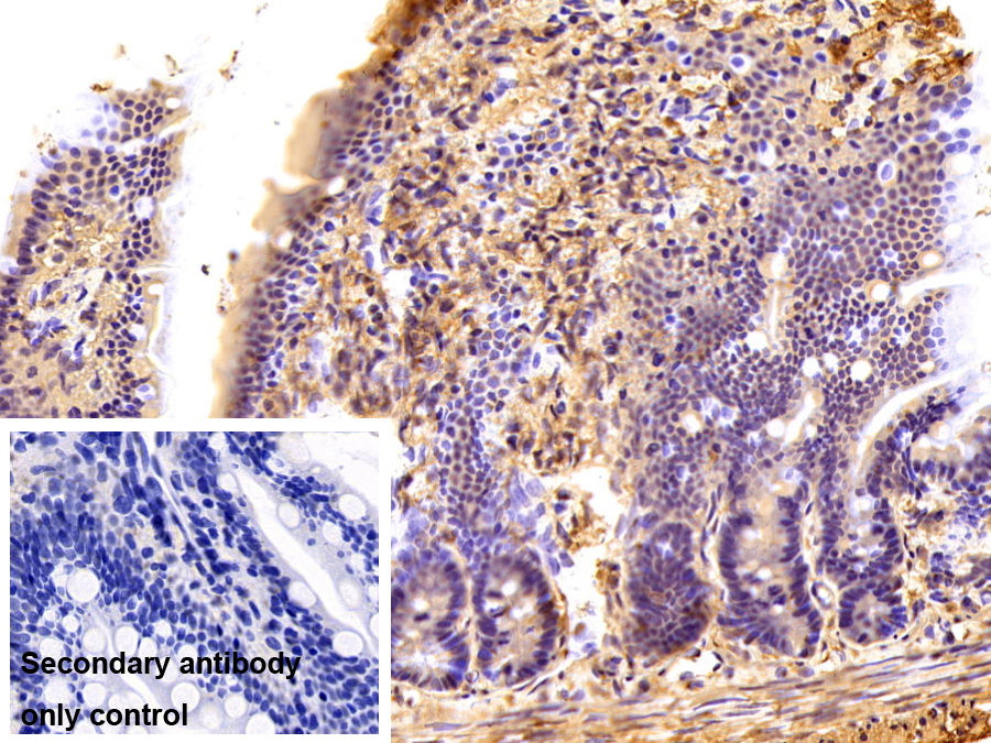 不均一核糖核蛋白A2/B1(HNRPA2B1)單克隆抗體