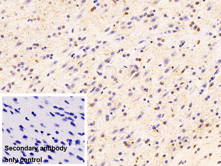 不均一核糖核蛋白A2/B1(HNRPA2B1)單克隆抗體