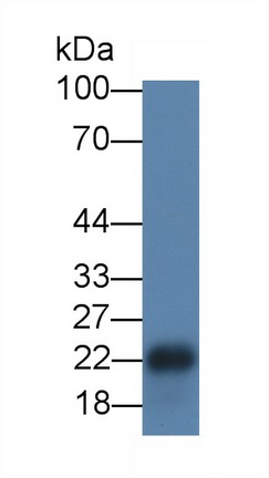 粘蛋白1(MUC1)单克隆抗体