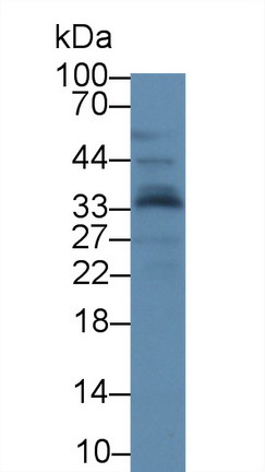 載脂蛋白A1(APOA1)單克隆抗體
