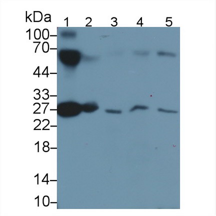 载脂蛋白A1(APOA1)单克隆抗体