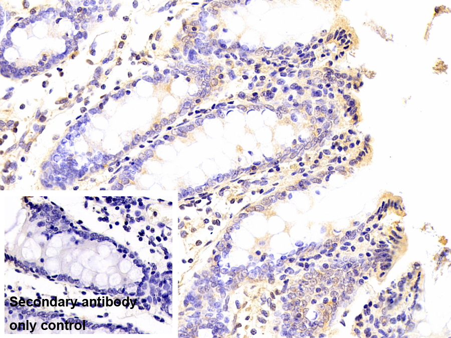 蛋白激酶R(PKR)單克隆抗體