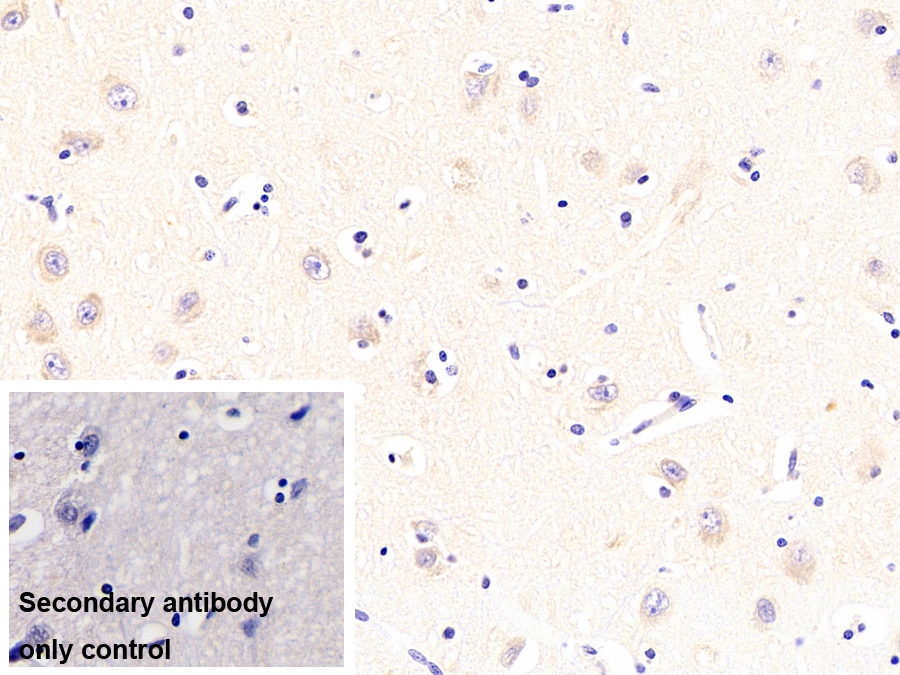 蛋白激酶R(PKR)單克隆抗體