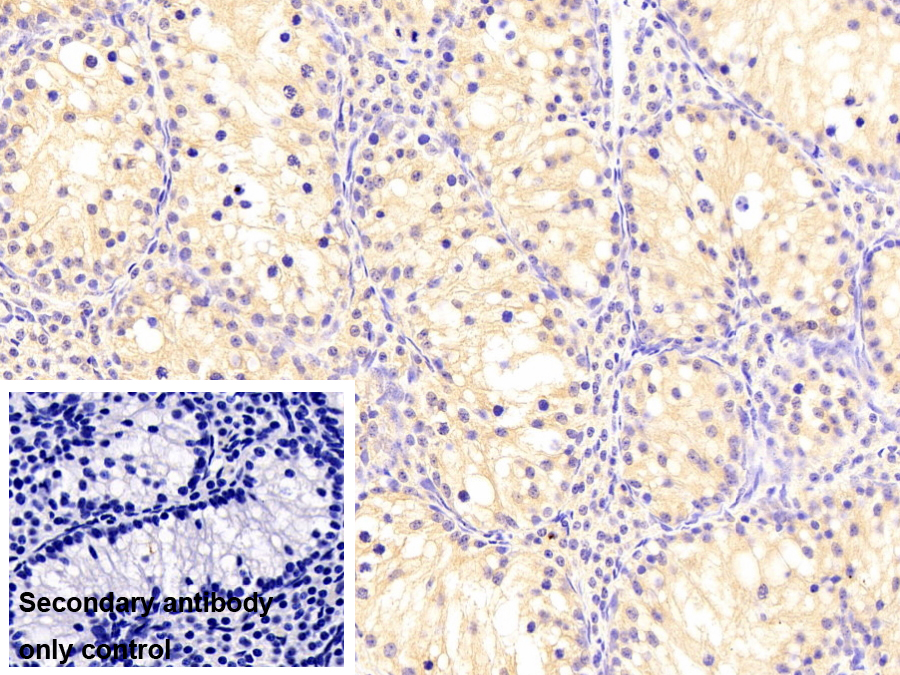 蛋白激酶R(PKR)單克隆抗體