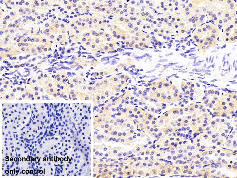 蛋白激酶R(PKR)單克隆抗體