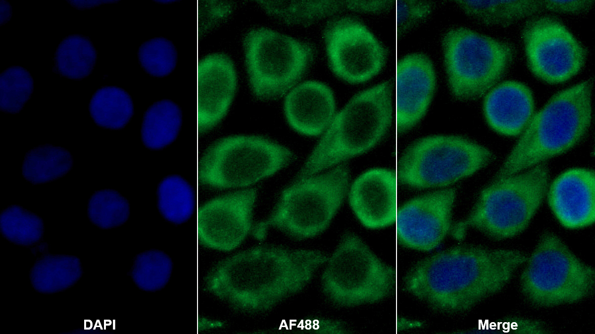 血小板衍生生長因子AA(PDGFAA)單克隆抗體