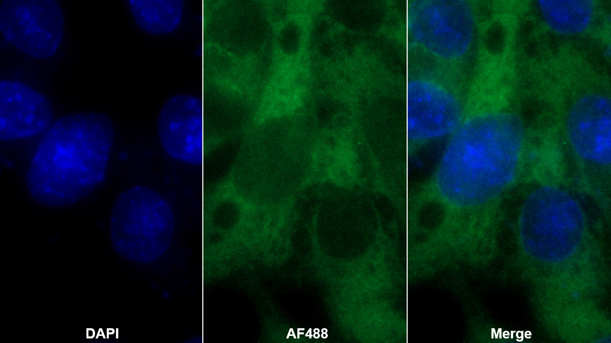 纖溶酶原激活物抑制因子2(PAI2)單克隆抗體