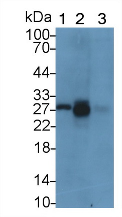 組織金屬蛋白酶抑制因子1(TIMP1)單克隆抗體