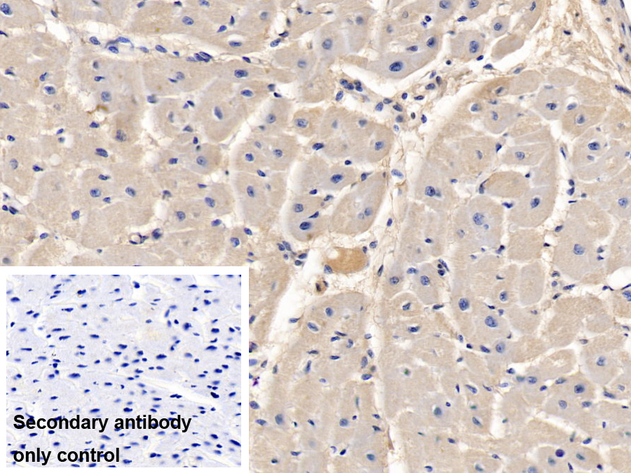 基質(zhì)金屬蛋白酶9(MMP9)單克隆抗體