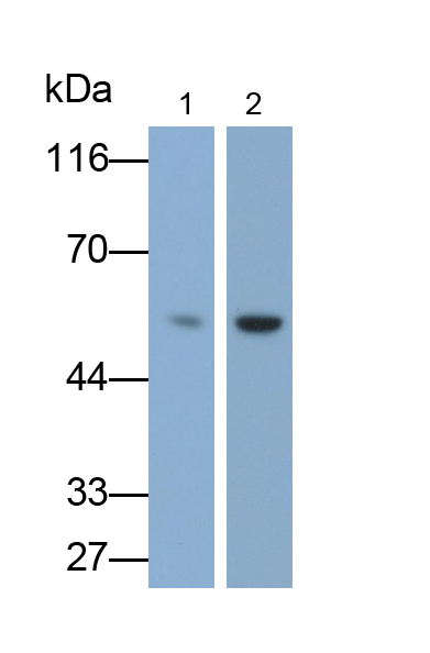 角蛋白7(CK7)單克隆抗體