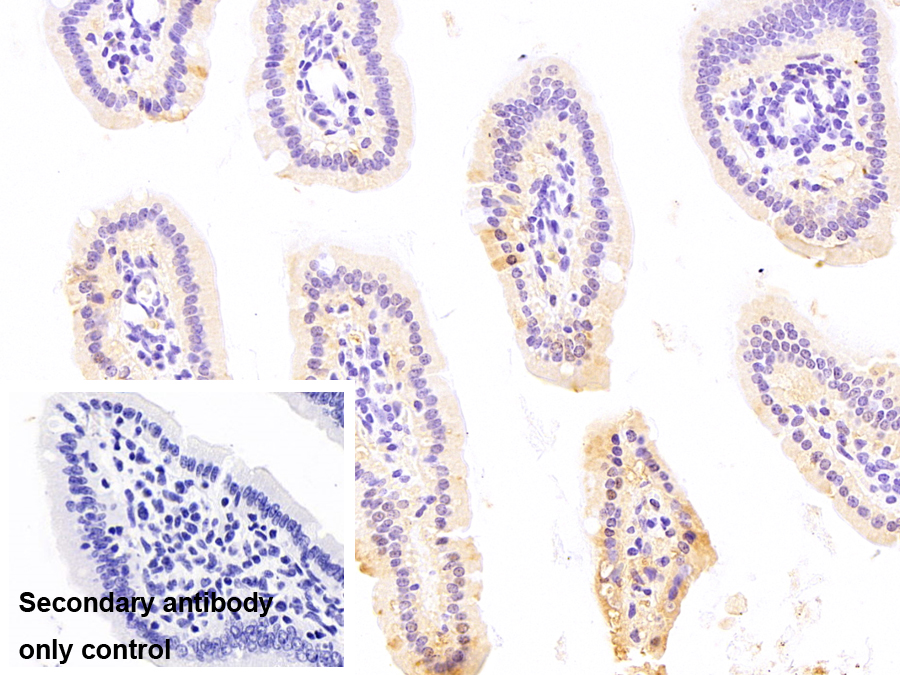 肠型脂肪酸结合蛋白(FABP2)单克隆抗体