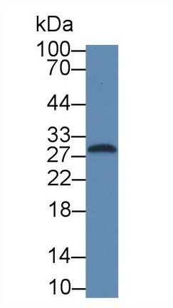 白介素1β(IL1b)單克隆抗體